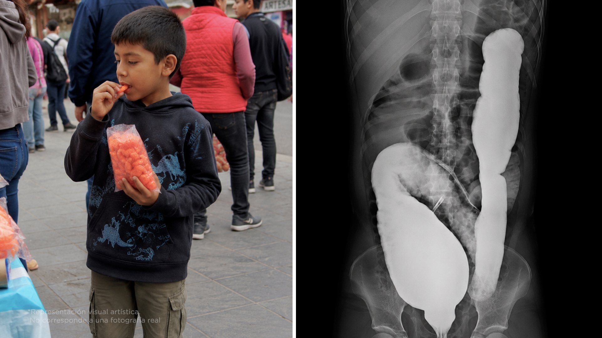 3 alimentos para niños relacionados con el cáncer