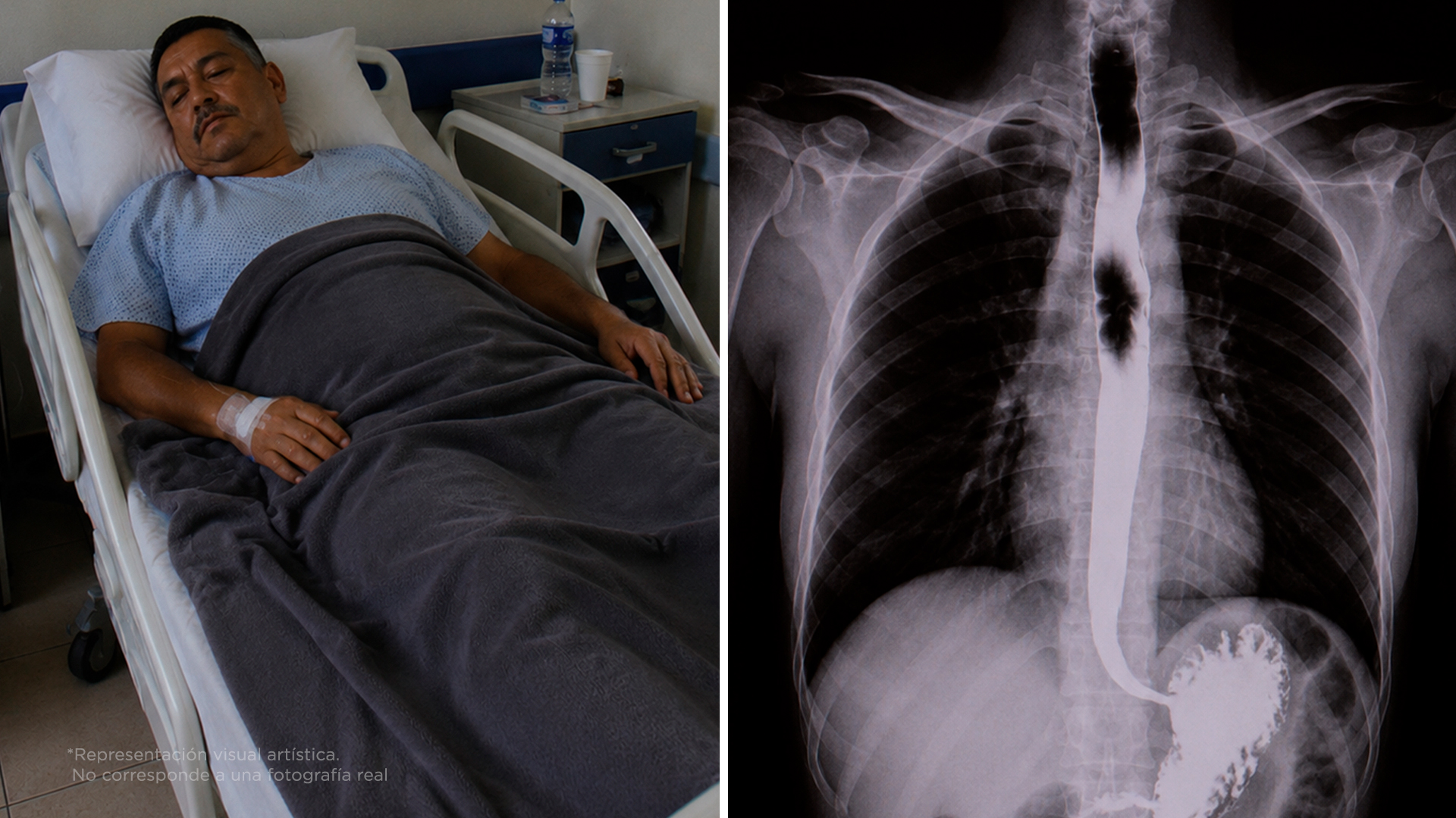3 hábitos que pueden ayudar a reducir el riesgo de cáncer