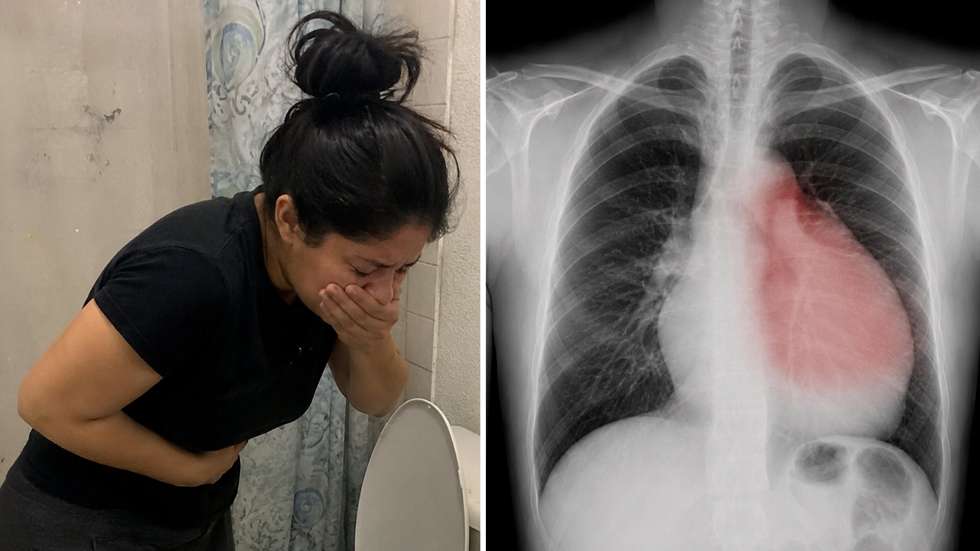 3 síntomas de infarto en mujeres que casi nadie reconoce