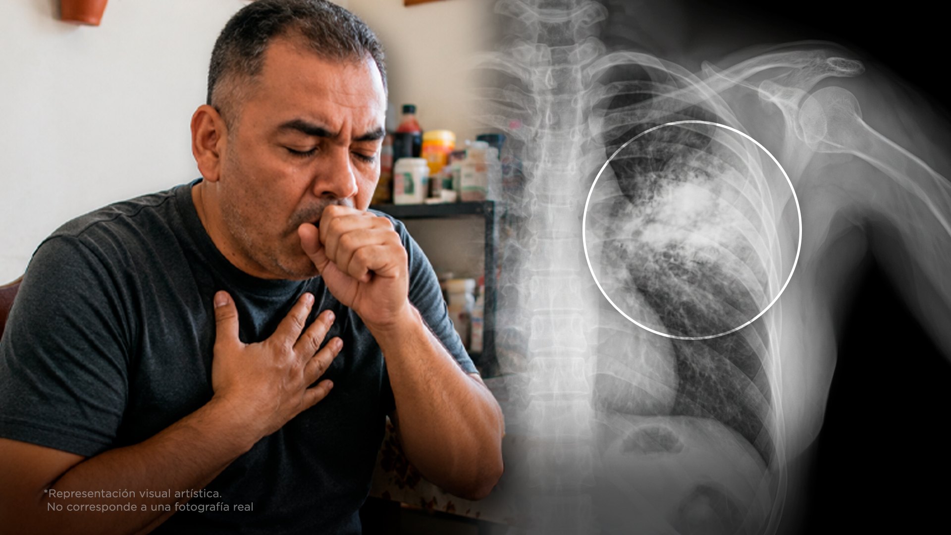 3 síntomas de que tus pulmones ya están enfermos y cómo sanarlos