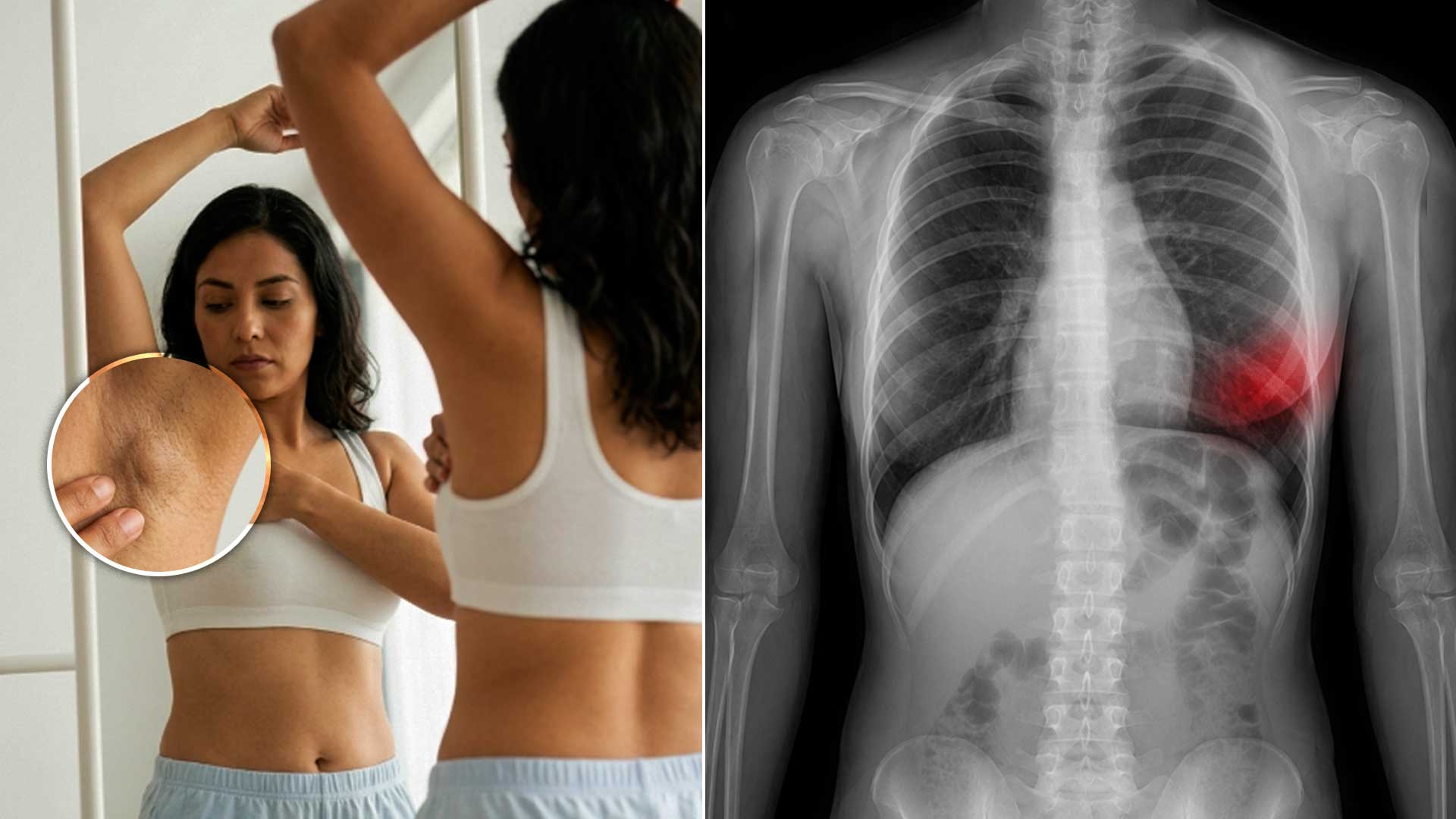 4 señales de cáncer de mama que la mayoría de las mujeres ignora