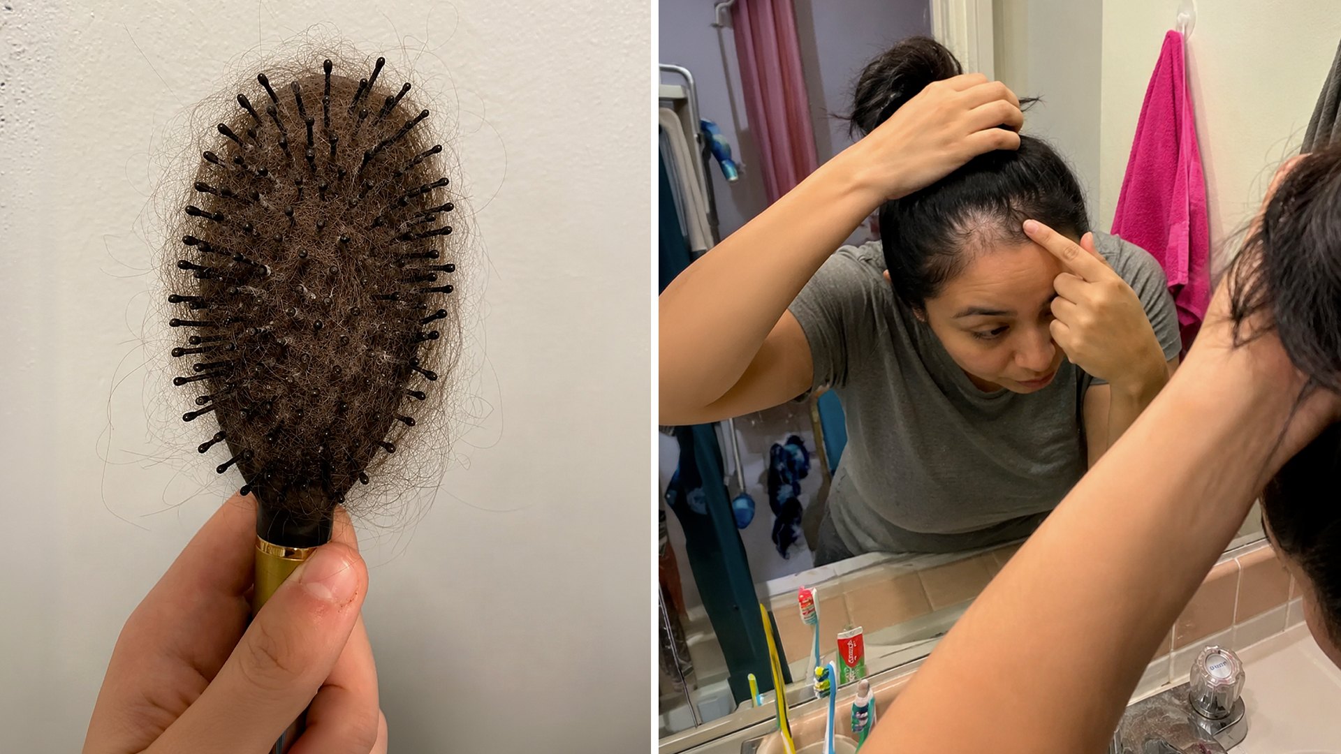 ¿Cabello en el cepillo? Cuándo es normal y cuándo ir al médico