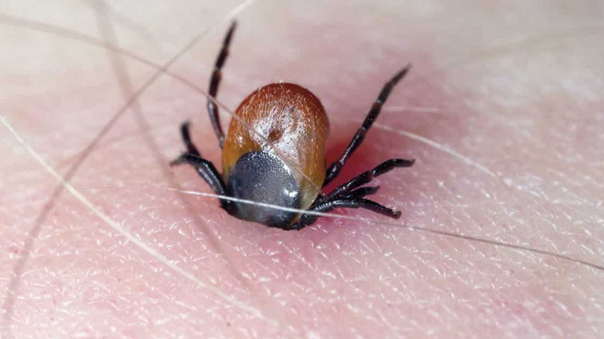 Cómo sobrevivir a la picadura de una garrapata