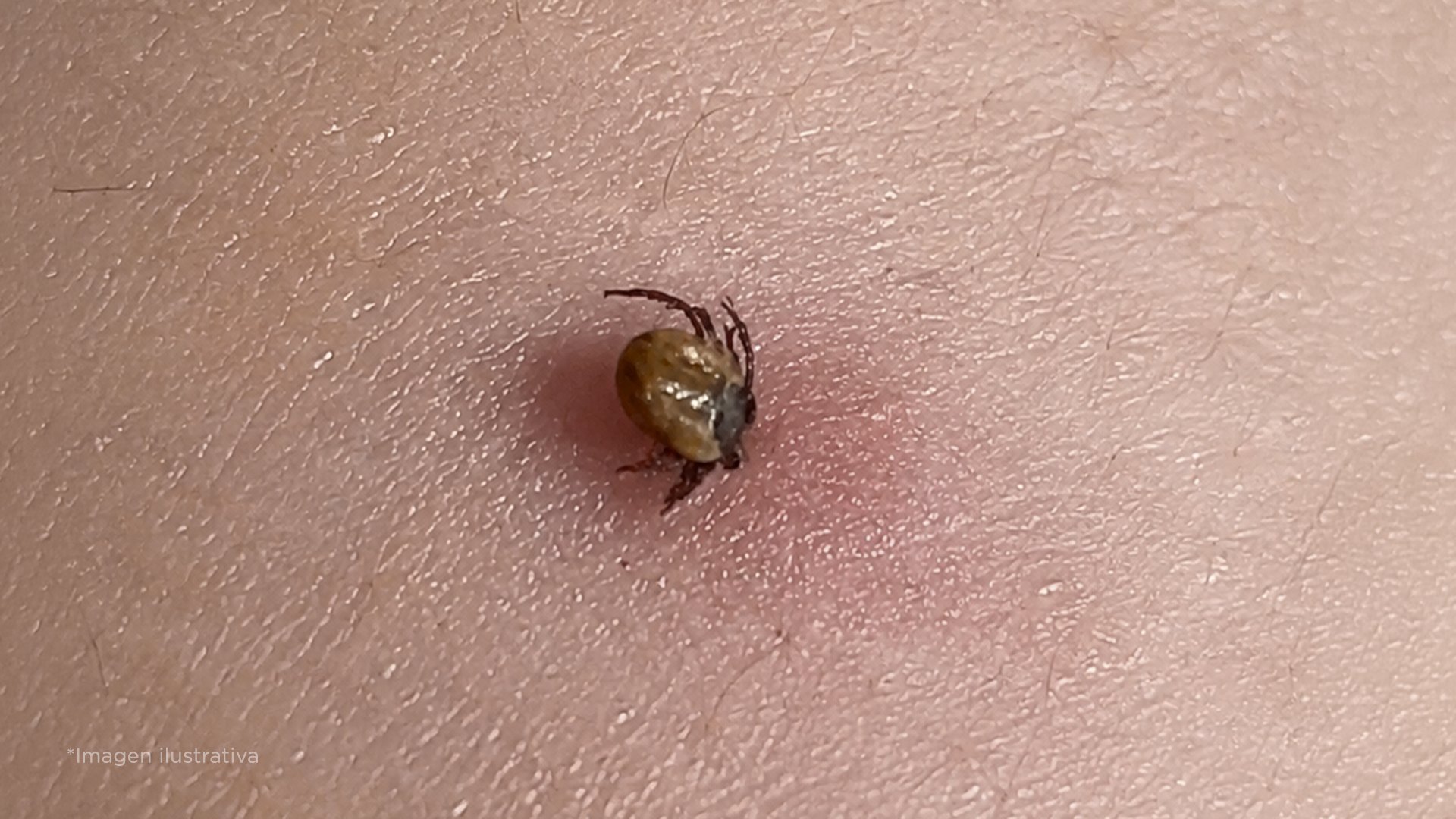 Cuidado: Así de peligrosas son las garrapatas