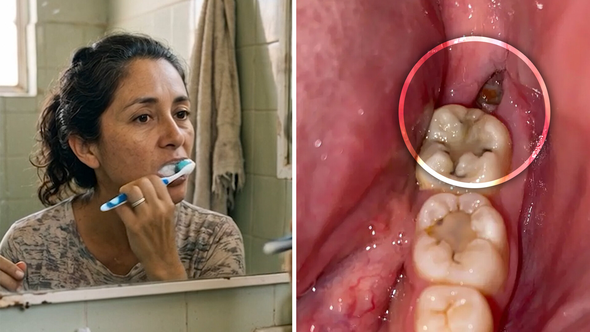 Después de comer, no te laves los dientes, solo enjuaga con agua.
