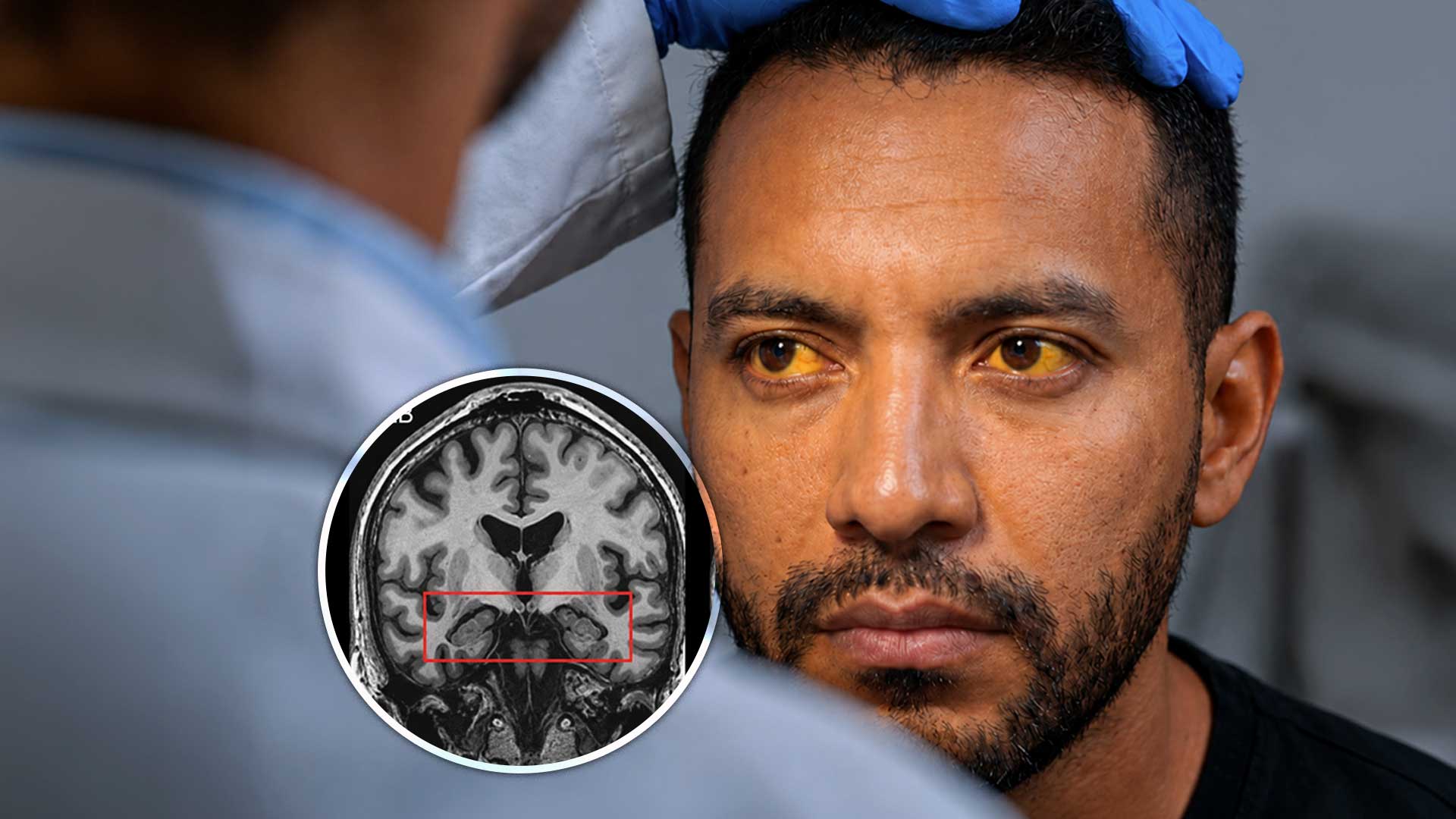 Dr. nos revela lo que el alcohol le hace a tu cerebro