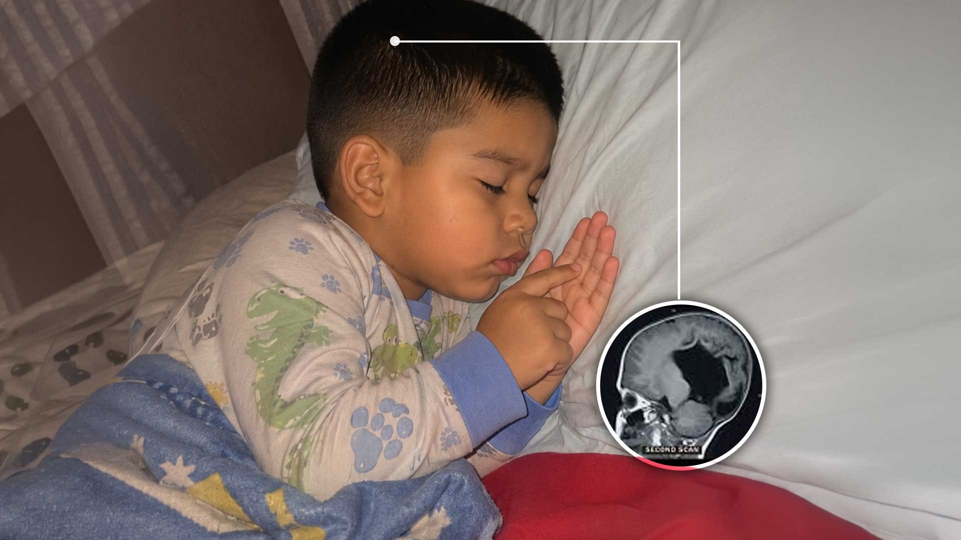 Esto le pasa al cerebro de un niño cuando deja el celular