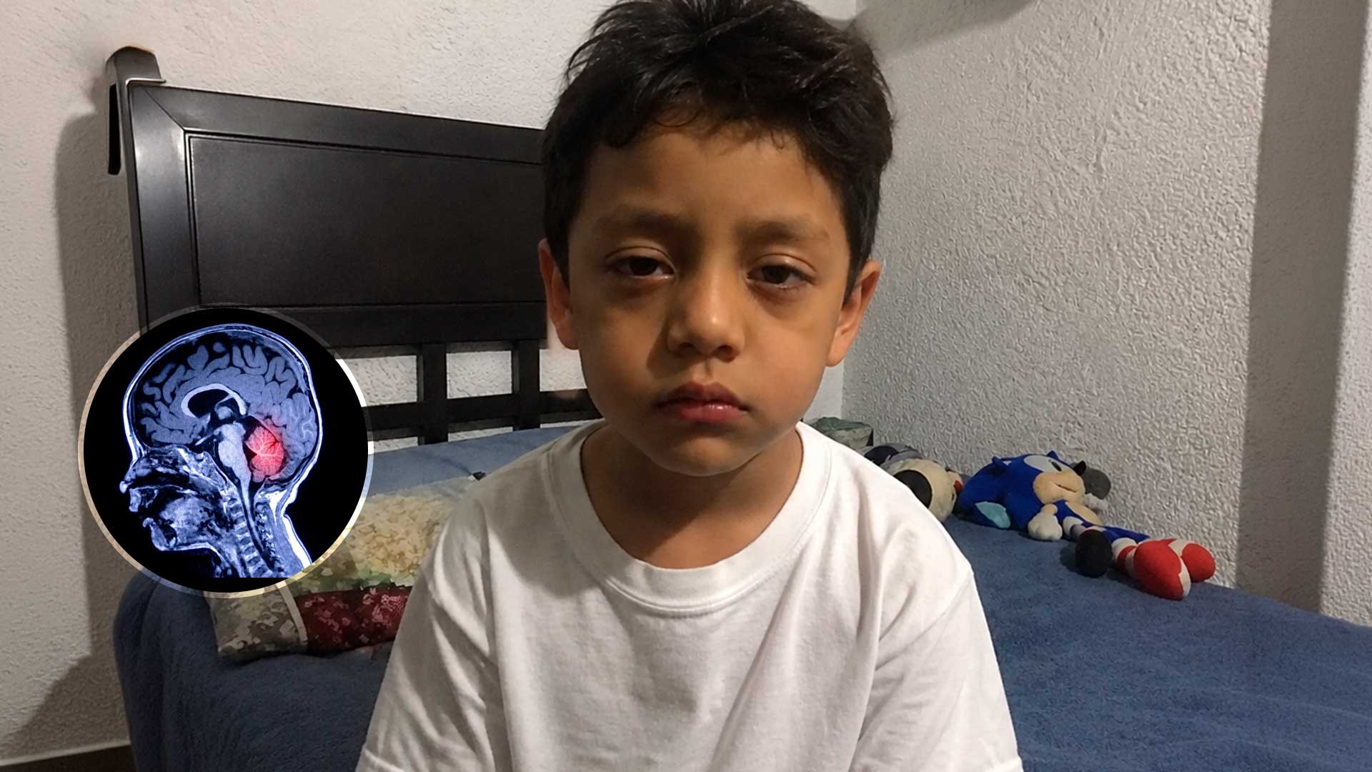 Esto le pasa al cerebro de un niño cuando se desvela