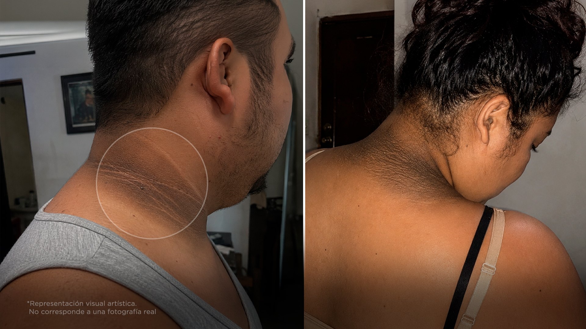 La mancha en el cuello no es mugre, es prediabetes, y es urgente que hagas esto