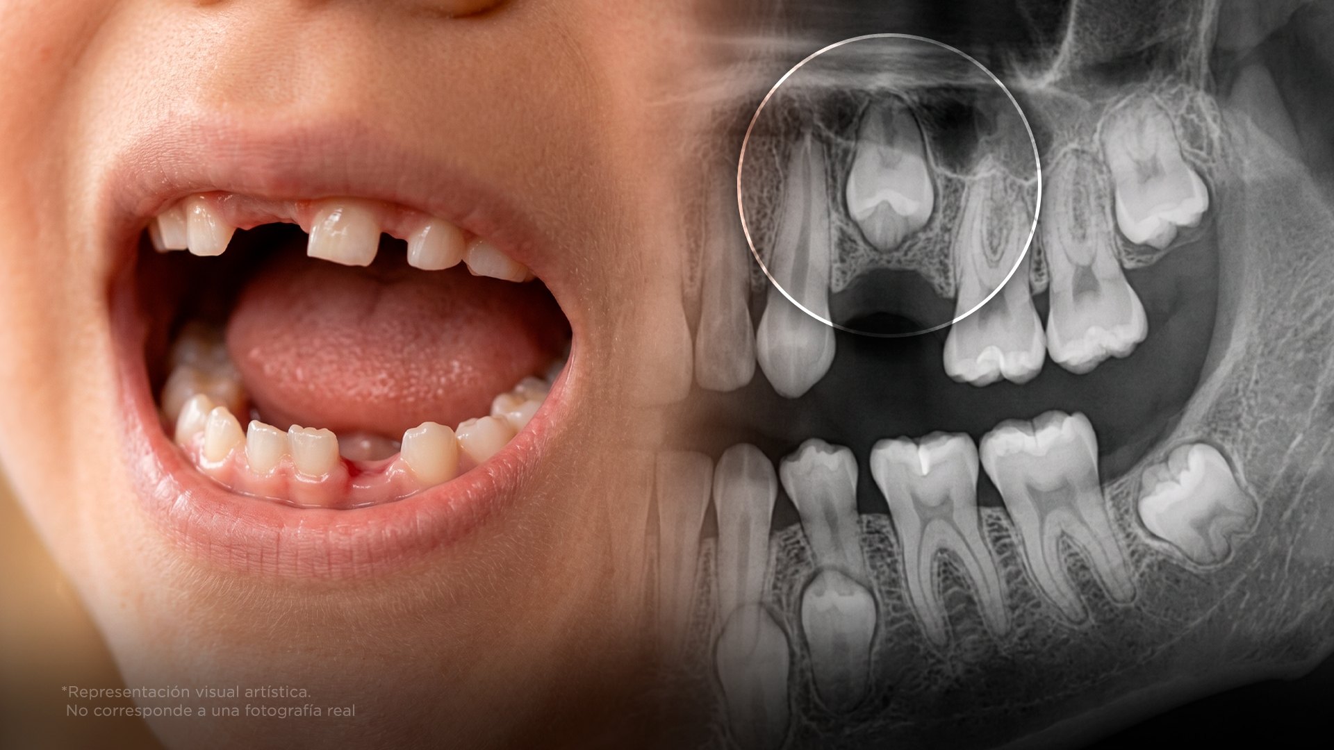 Por qué algunos padres congelan los dientes de sus hijos