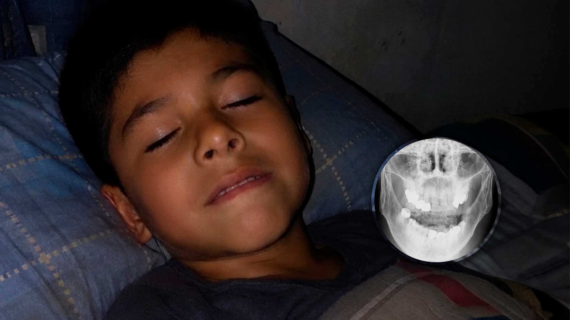 Si tu hijo rechina los dientes al dormir, debes hacer esto