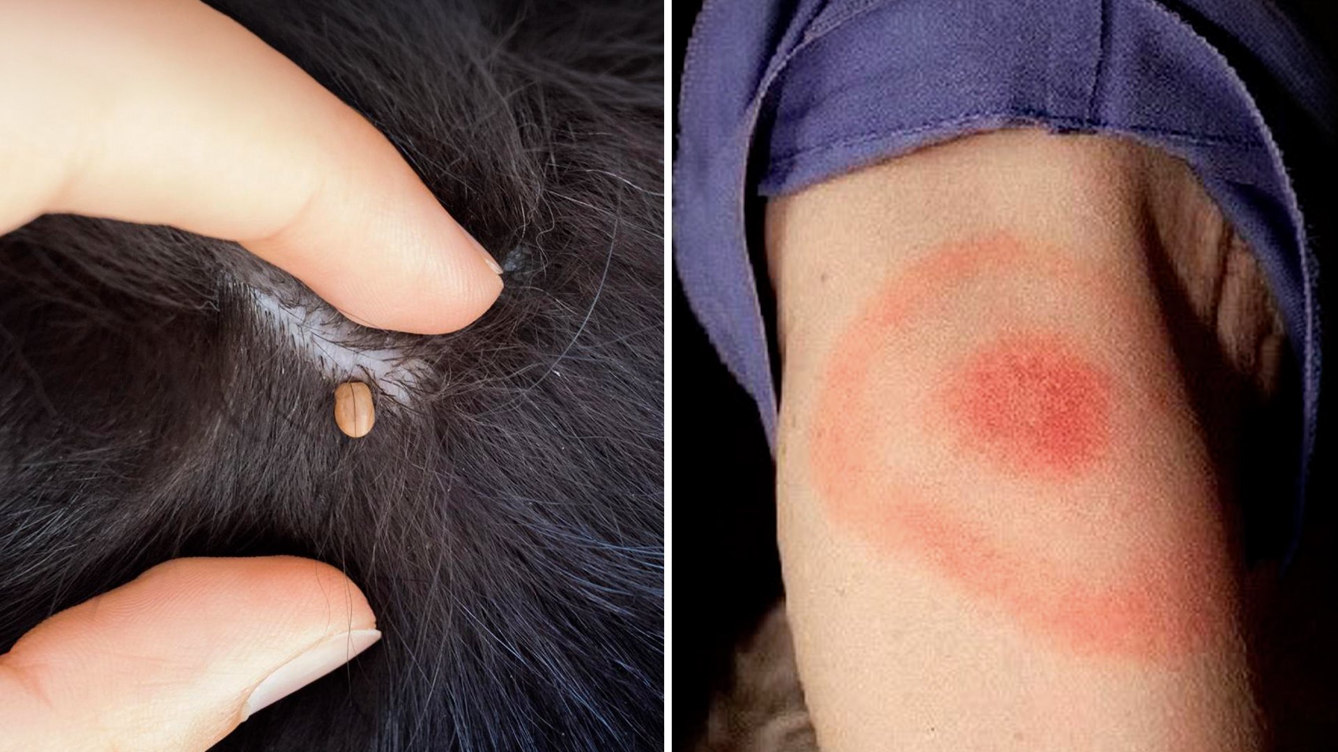Si tu perro tiene garrapatas, esto es lo que puede pasarte a ti